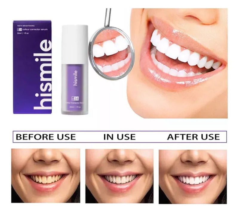 🔥Últimas Unidades 🔥HI SMILE - BLANQUEADOR DE DIENTES +Envio Gratis